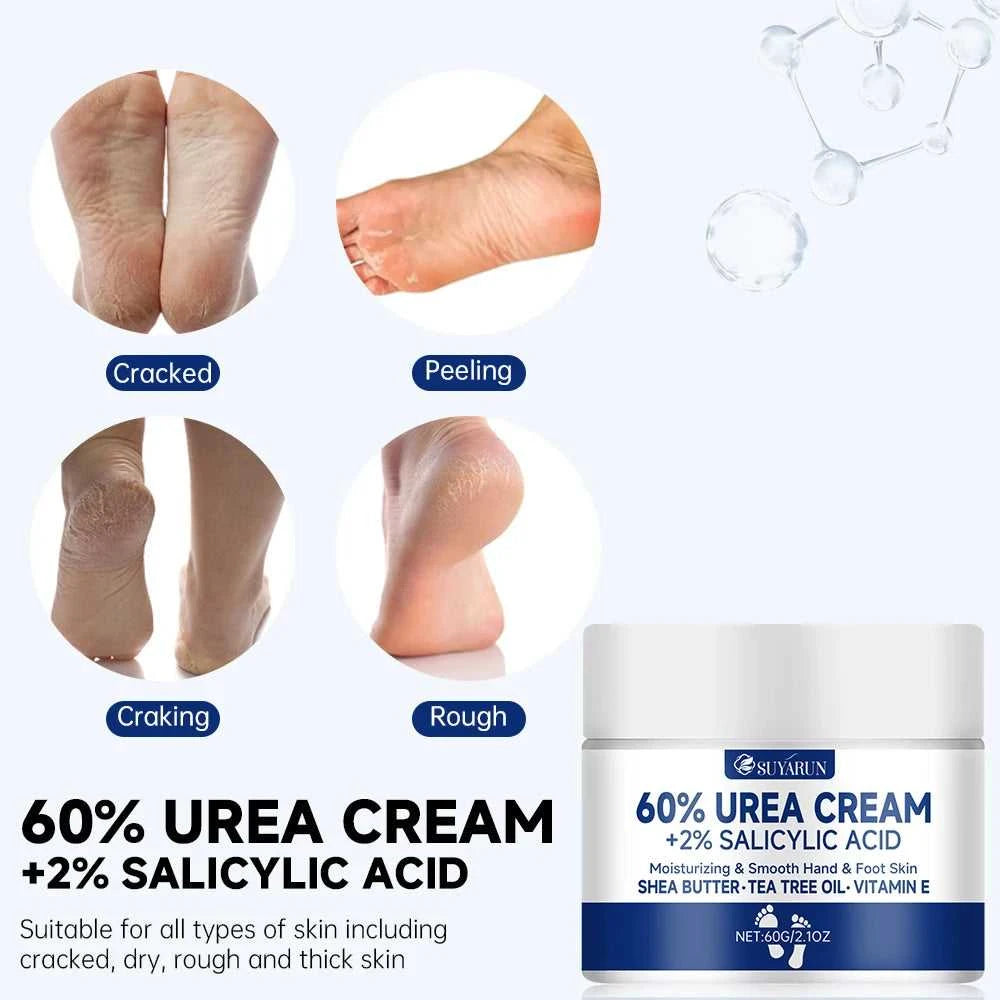 SUYARUN 60% Urea Foot Cream for Cracked Heels & Dry Skin - Intensive Moisturizing Treatment, Callus Remover, Diabetic Foot Care. Éditions Traditions & Modernité Inc. 185981107;20260611;1781193792Z4TqB