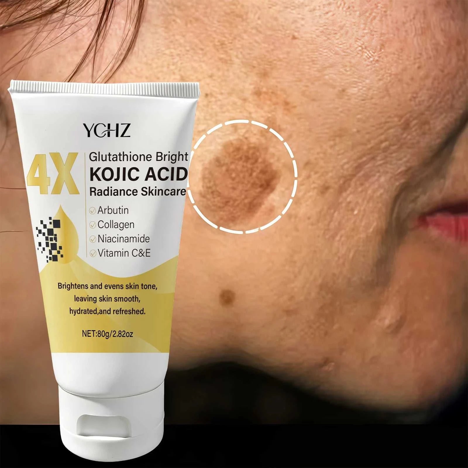 Kojic Acid Face Cream Evens Out Skin Tone, Eliminates Dark Spots and Dullness - Non-Greasy, Suitable for Both Men and Women - Whitening and Moisturizing Cream, for Day and Night Use Éditions Traditions & Modernité Inc. 185980834;20260611;1781193694yZksk